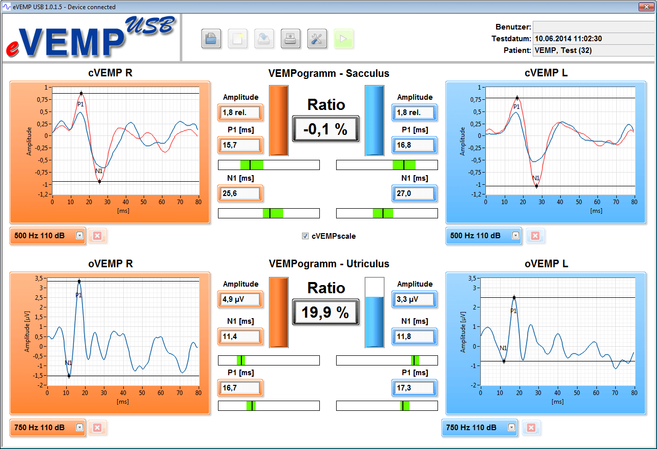 C and O vemp screenshot