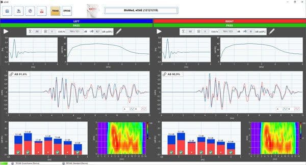 Biomed eOAE Display 2