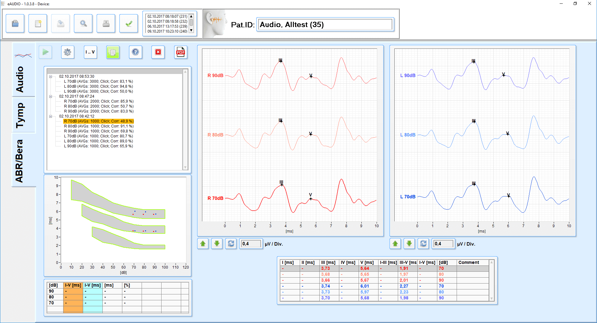 Biomed eABR display 2